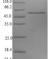 Human Synaptosomal-associated protein 29 (SNAP29) Recombinant Protein - BioCrest Sci