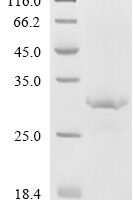 Human Replication protein A 32 kDa subunit (RPA2), partial Recombinant Protein, C-His - BioCrest Sci