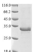 Human Oncostatin-M-specific receptor subunit beta (OSMR), partial Recombinant Protein - BioCrest Sci
