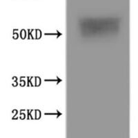 Human Urea transporter (SLC14A1)-VLPs Recombinant Protein - BioCrest Sci