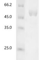 Human Ribonuclease 4 (RNASE4) Recombinant Protein, C-hFc1 - BioCrest Sci