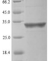Human Valacyclovir hydrolase (BPHL) Recombinant Protein, N-10His/C-Myc, aa 38–291, Yeast - BioCrest Sci