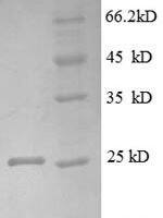 Human Tumor necrosis factor receptor superfamily member 3 (LTBR), partial Recombinant Protein, N-His, aa 31–227, MW 25.4kDa - BioCrest Sci