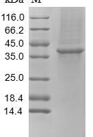 Rabbit Tissue factor pathway inhibitor (TFPI) Recombinant Protein, N-10His - BioCrest Sci