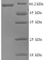 Human Probable imidazolonepropionase (AMDHD1) Recombinant Protein - BioCrest Sci