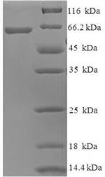 Human Probable imidazolonepropionase (AMDHD1) Recombinant Protein, Homo sapiens (Human), E.coli, N-terminal 6xHis-SUMO-tagged, 62.7 kDa, purity >≥ 90% as determined by SDS-PAGE.