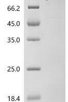 Escherichia coli Aconitate hydratase Recombinant Protein, N-10His/C-Myc - BioCrest Sci
