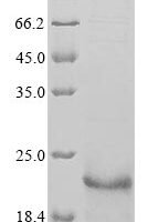 Arabidopsis thaliana Ubiquitin-conjugating enzyme E2 10 (UBC10) Recombinant Protein - BioCrest Sci
