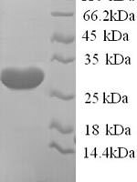Human Potassium voltage-gated channel subfamily D member 2 (KCND2), partial Recombinant Protein - BioCrest Sci