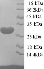 Human Potassium voltage-gated channel subfamily D member 2 (KCND2), partial Recombinant Protein, Homo sapiens (Human), Yeast, N-terminal 6xHis-tagged, 27.0 kDa, purity >≥ 90% as determined by SDS-PAGE.