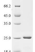 Human Alpha-synuclein (SNCA) Recombinant Protein - BioCrest Sci