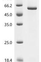 Human Hyaluronidase PH-20 (SPAM1) Recombinant Protein, C-His, aa 36–490, E.coli - BioCrest Sci