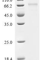 Human Cellular tumor antigen p53 (TP53) Recombinant Protein, C-10His - BioCrest Sci
