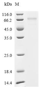 Human Cellular tumor antigen p53 (TP53) Recombinant Protein, C-10His, Homo sapiens (Human), Mammalian cell, C-terminal 10xHis-tagged, 49.9 kDa, purity >≥ 85% as determined by SDS-PAGE.