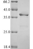 Human B-lymphocyte antigen CD20 (MS4A1), partial Recombinant Protein, N-GST - BioCrest Sci