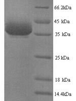 Mouse Y-box-binding protein 1 (Ybx1) Recombinant Protein - BioCrest Sci