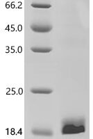 Human herpesvirus 2 E3 ubiquitin-protein ligase ICP0 (RL2), partial Recombinant Protein - BioCrest Sci