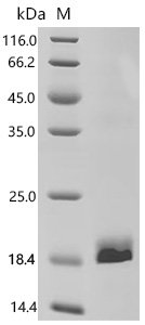 Human herpesvirus 2 E3 ubiquitin-protein ligase ICP0 (RL2), partial Recombinant Protein, E.coli, C-terminal 6xHis-tagged, 17.5 kDa, purity >≥ 90% as determined by SDS-PAGE.