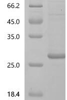 Rift valley fever virus Nucleoprotein (N) Recombinant Protein - BioCrest Sci