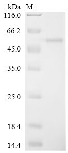 Mouse Phospholipid transfer protein (Pltp) Recombinant Protein, N-His, Mus musculus (Mouse), E.coli, N-terminal 6xHis-tagged, 56.7 kDa, purity >≥ 90% as determined by SDS-PAGE.