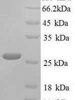 Klebsiella pneumoniae Metallo-beta-lactamase type 2 (blaNDM-1) Recombinant Protein, N-His - BioCrest Sci