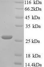 Klebsiella pneumoniae Metallo-beta-lactamase type 2 (blaNDM-1) Recombinant Protein, N-His, Klebsiella pneumoniae, Yeast, N-terminal 6xHis-tagged, 27.6 kDa, purity >≥ 90% as determined by SDS-PAGE.