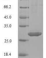 Human Interleukin-4 (IL-4) Recombinant Protein - BioCrest Sci