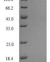 Human Putative protein SFTA3 (SFTA3) Recombinant Protein, N-His - BioCrest Sci