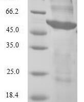 Human 5'-AMP-activated protein kinase subunit beta-2 (PRKAB2) Recombinant Protein - BioCrest Sci