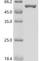 Mouse Major vault protein (Mvp), partial Recombinant Protein, C-His, aa 1–385 - BioCrest Sci