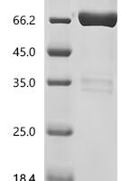 Human Pro-neuregulin-1, membrane-bound isoform (NRG1), partial Recombinant Protein, C-hFc1 - BioCrest Sci