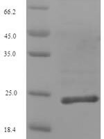 Human Collagen alpha-1 (XII) chain (COL12A1), partial Recombinant Protein - BioCrest Sci