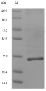 Human Collagen alpha-1 (XII) chain (COL12A1), partial Recombinant Protein, Homo sapiens (Human), E.coli, N-terminal 6xHis-tagged, 23.5 kDa, purity >≥ 90% as determined by SDS-PAGE.