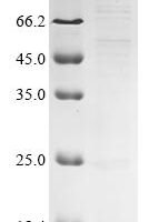 Human Prostaglandin D2 receptor (PTGDR), partial Recombinant Protein - BioCrest Sci