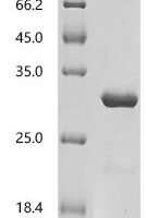 Dog Lipocalin Can f 6.0101 Recombinant Protein, C-His, aa 16–190, E.coli - BioCrest Sci