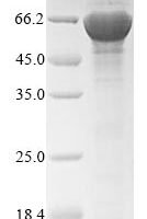 Candida glabrata Acetyl-CoA carboxylase (AO440_004758), partial Recombinant Protein - BioCrest Sci