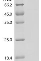 Human Cadherin-19 (CDH19), partial Recombinant Protein - BioCrest Sci