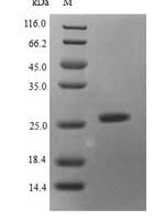 Mouse Histone deacetylase complex subunit SAP130 (Sap130), partial Recombinant Protein, N-His, aa 845–1057, Yeast - BioCrest Sci