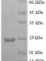 Gallus gallus Vesicle-associated membrane protein 7 (VAMP7)
, partial Recombinant Protein - BioCrest Sci