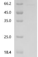 Human Desmoglein-1(DSG1),partial Recombinant Protein - BioCrest Sci