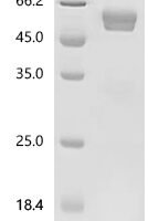 Human Fms-related tyrosine kinase 3 ligand (FLT3LG), partial Recombinant Protein - BioCrest Sci