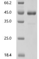 Human Activin receptor type-1 (ACVR1), partial Recombinant Protein - BioCrest Sci