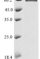 Bat coronavirus HKU9 Nucleoprotein (N) Recombinant Protein - BioCrest Sci