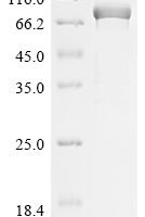 Human Myosin-6 (MYH6), partial Recombinant Protein, N-His, aa 160–816, E.coli - BioCrest Sci