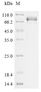 Human Myosin-6 (MYH6), partial Recombinant Protein, N-His, aa 160–816, E.coli, Homo sapiens (Human), E.coli, N-terminal 6xHis-tagged, 80.7 kDa, purity >≥ 85% as determined by SDS-PAGE.