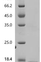 Human Seizure protein 6 homolog (SEZ6), partial Recombinant Protein, C-10His, aa 355–414, E.coli - BioCrest Sci