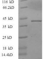 Macaca mulatta Interleukin 17A (IL17A) Recombinant Protein - BioCrest Sci