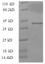 Macaca mulatta Interleukin 17A (IL17A) Recombinant Protein, Macaca mulatta (Rhesus macaque), E.coli, N-terminal GST-tagged, 42.1 kDa, purity >≥ 90% as determined by SDS-PAGE.