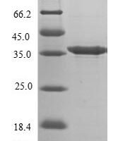 Mouse Decorin (Dcn), partial Recombinant Protein, N-His, aa 35–354, E.coli - BioCrest Sci