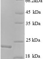Human GTPase KRas (KRAS), partial Recombinant Protein - BioCrest Sci